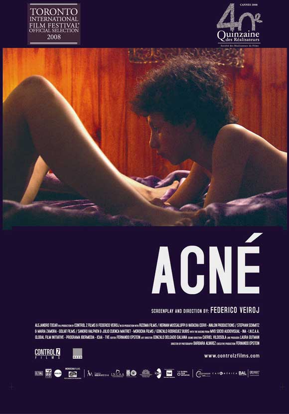 Poster of Acne